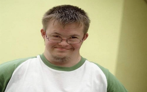 详谈唐氏综合症是什么,常常还会引发这8种并发症柚喜>试管婴儿>攻略