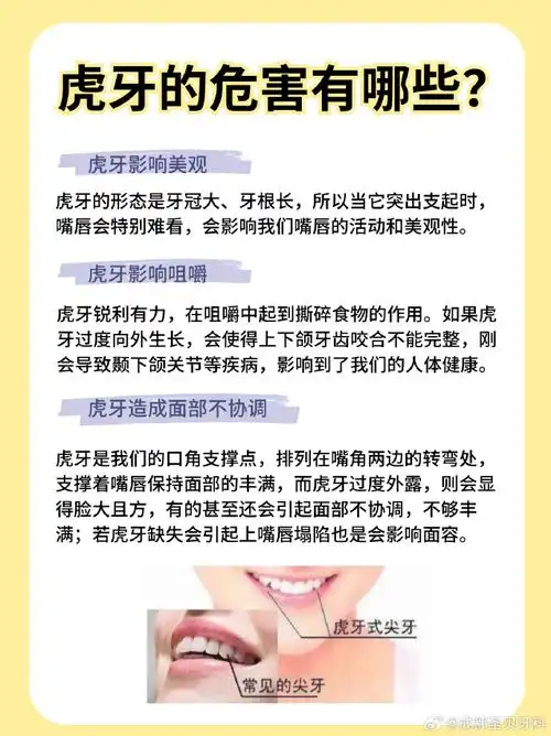 虎牙能不能拔掉##虎牙需要矫正吗##虎牙正畸