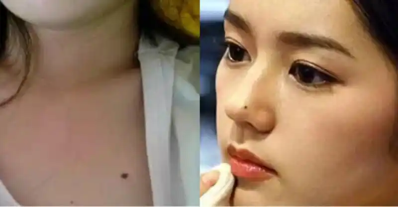 【命理解析】女人不想婚姻不幸,财运不济,一定要去掉这9颗「霉运痣」!