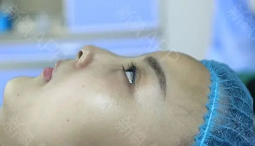 我一直感觉自己的鼻子没发育好,软趴趴的贴在脸上,一_圈子-新氧美容