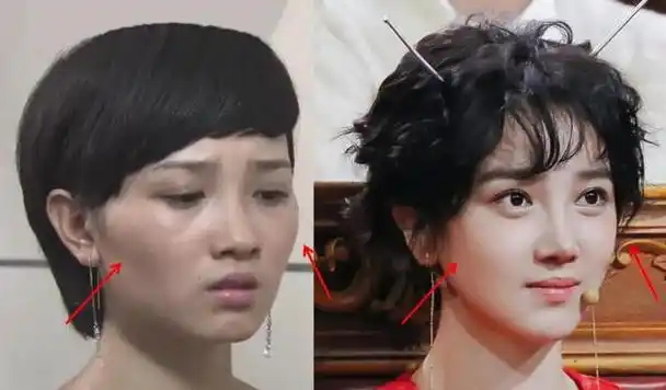 娱乐圈里哪些女明星整容比较成功,变得更加美丽了