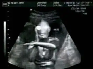 搞笑怀孕套路图奥特曼