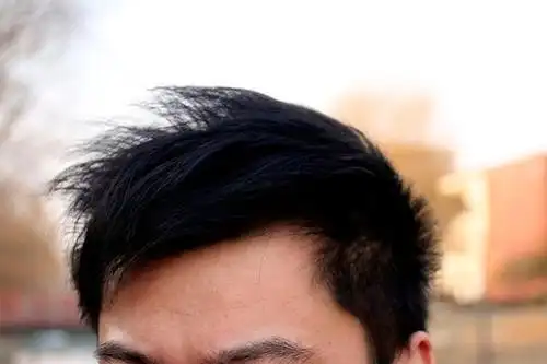 年轻人长白头发的原因是什么?