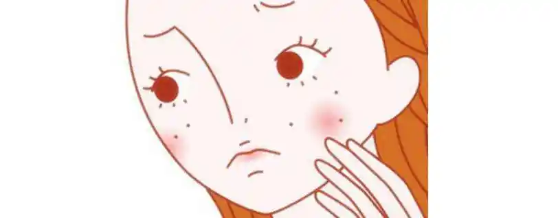 闭口粉刺怎么去除 名门泽佳教你粉刺有效改善小窍门