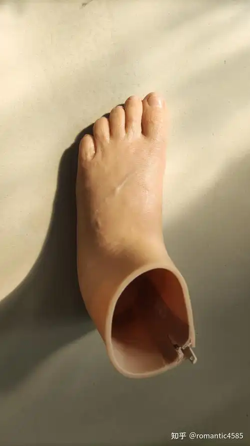 一例半足截肢患者制作硅胶拉链假肢的制作流程介绍