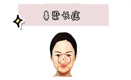 女人4颗"妨夫"痣,上不孝,下不教,花钱大手,不会过日子!