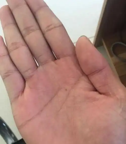 手相生命线呈现眼睛纹路年轻时老公嫌弃命中注定苦一世