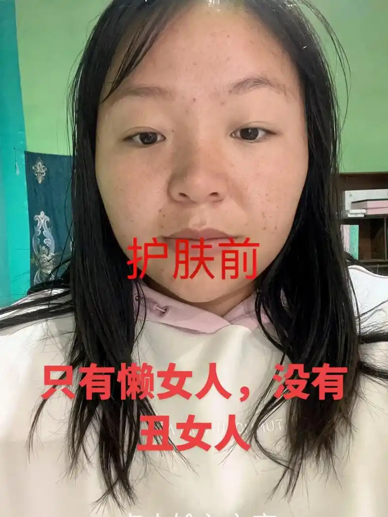 由于最近熬夜比较多所以皮肤状态比较差