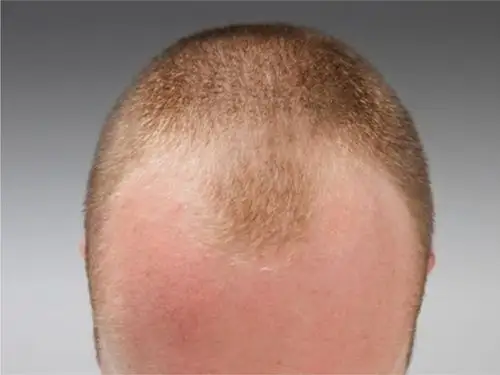 5大男星「剃光头」man爆 彭于晏帅到想抱,吴亦凡潮到出水