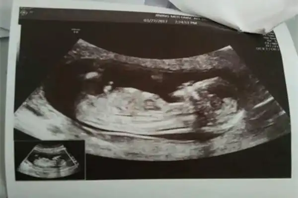 已生女儿 nt 最明显的女宝特征看数据