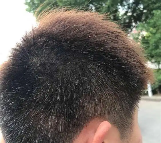 年纪轻轻便满头白发?这些问题你都犯了吗?