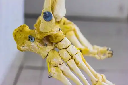 在白色背景下显示人踝关节解剖的铰接跖和指骨骨照片