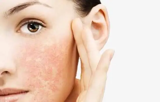 干性敏感肌肤适合用哪种护肤品干皮如何护肤