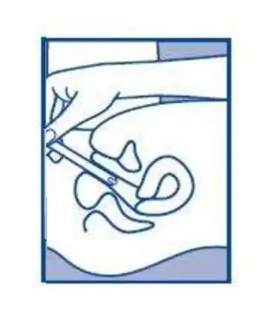 药师教您正确用药,摆脱难言之隐_栓剂