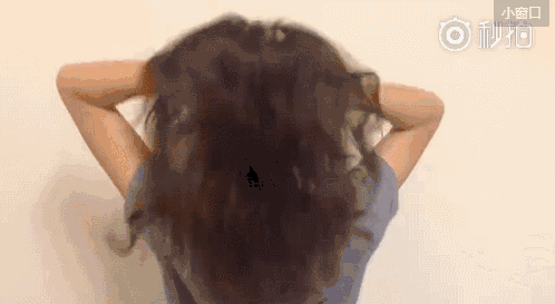 脱发,秃顶伤透心,该如何是好?