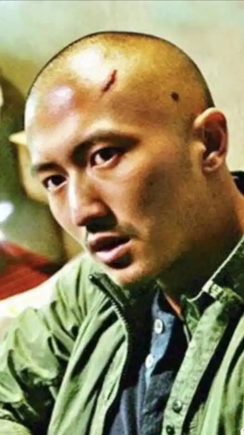 黑痣病变为黑色素瘤,影星谢霆锋庆幸因饰演角色剃光头发现及时