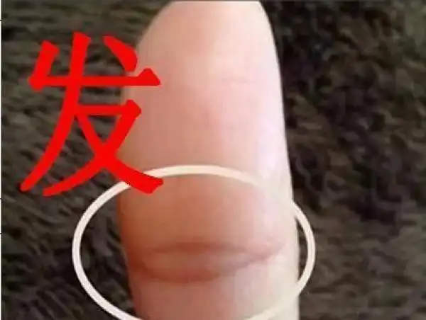 生命线若出现眼睛纹,命苦一世,若手相出现凤眼纹,后半生必命好!