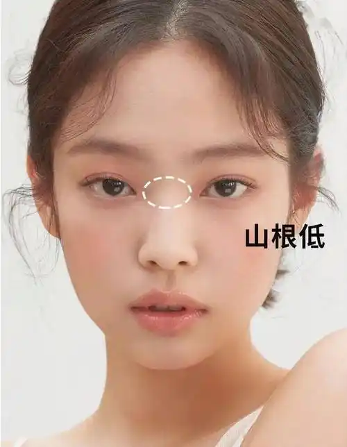 塌鼻梁,低 山根与其死磕鼻子缺陷,不如找对变美思路,让五官达到视觉