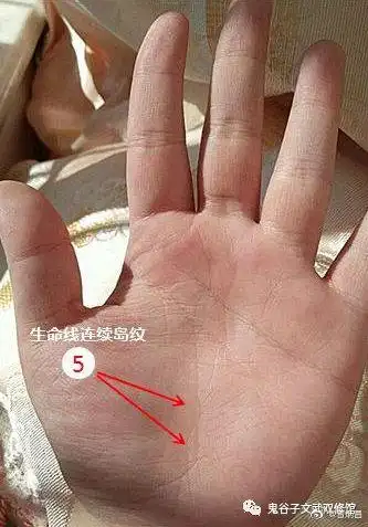 子宫长瘤;掌中央处有鸟纹,预示胸部或消化器官有癌症,如肺癌或胃癌;而