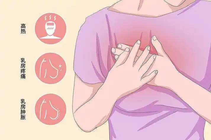乳腺增生症: 异常的乳腺组织增生可导致乳房胀硬,乳头敏感和按压疼痛.