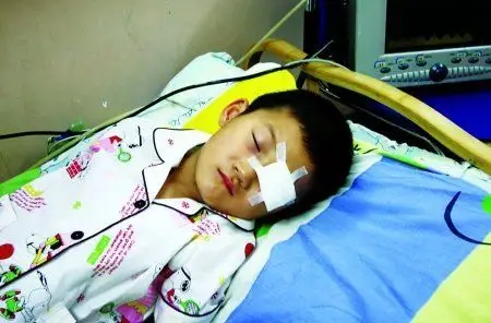 了给小佳做手术的眼外科医生魏文龙,听他讲述关于儿童眼外伤的那些事