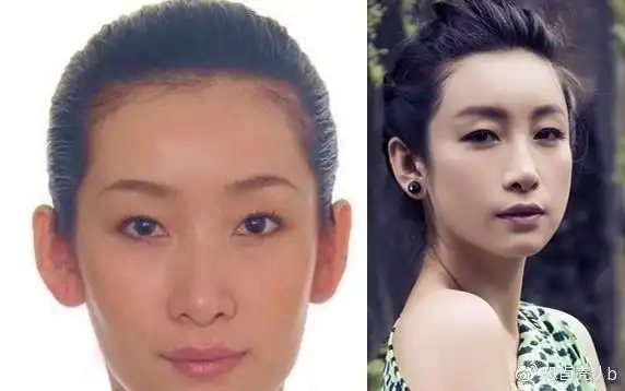 秦海璐为她单眼皮上1000万保险为什么后来割了