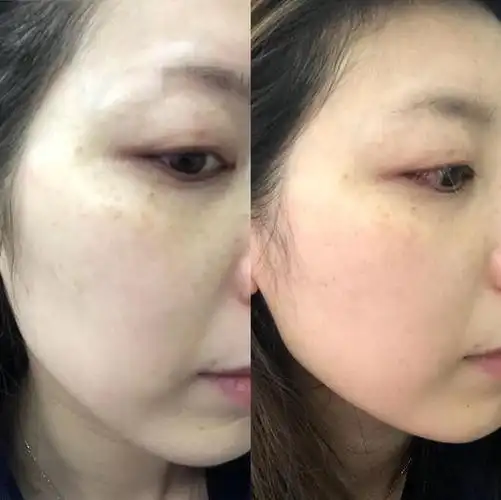 特地使用了3天再来写评语,还留了照片对比,还是能看出变化的,希望4支