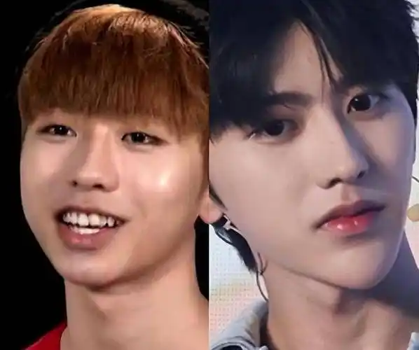 蔡徐坤整容对比前后蔡徐坤整容网红前照片