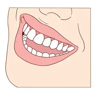 露 i>齿 /i>微笑 i>图 /i> i>片 /i>免抠png透明 i>图 /i>层素材