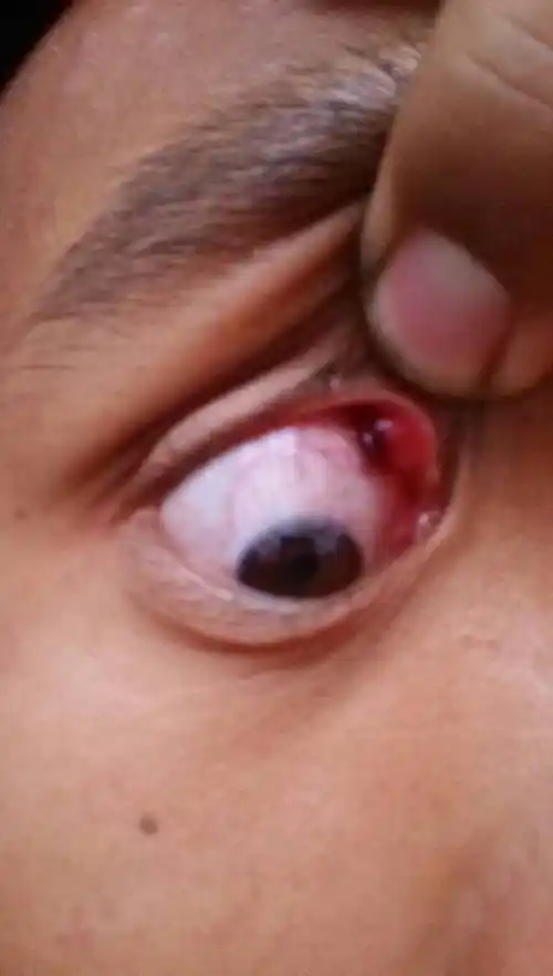 都半年多了!但是就今天才变成紫红色的