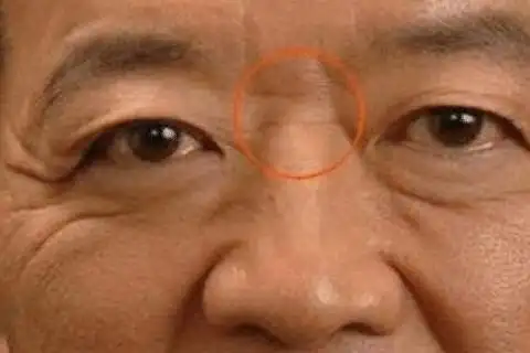 鼻子上有横纹的面相好不好 需克服种种困难-开运随记