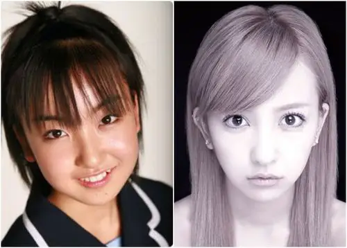 你和石原里美新垣结衣之间真的只差一个日本整容医生吗