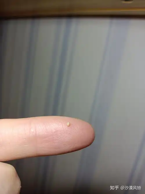 阴茎皮里面皮下非龟头上面有几个颗粒样的东西把阴茎皮扯起来摸有点像