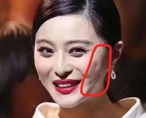 景甜生图被嘲姨味扑鼻双眼皮修好后又坠崖成悲伤蛙20do错了啥