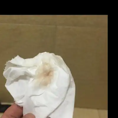 怀孕41天有浅褐色分泌物,也不多,两天了,这两天也一直在家卧床休息呢