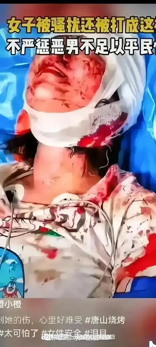 唐山打人事件,这个视频我看了很多遍,都没有看到一个真正的结果 - 抖