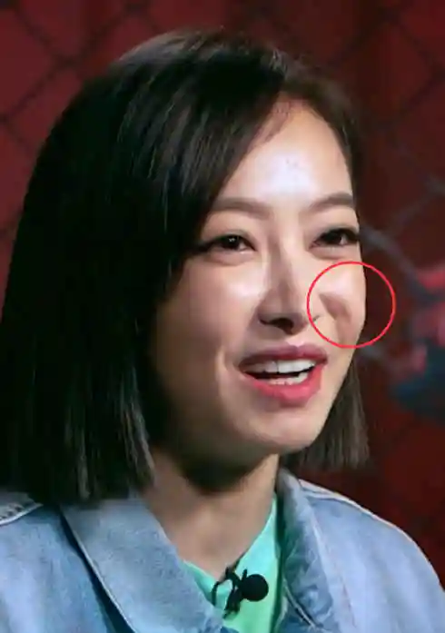 宋茜在本次《热血街舞团》的采访过程中笑容僵硬,脸部肌肉突出,笑容