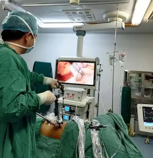 云梦县人民医院泌尿外科成功完成一例腹腔镜半尿路切除术