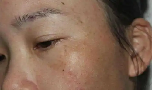 "面色差"用上千块护肤品都没效?先看看身体的这里有没有出问题