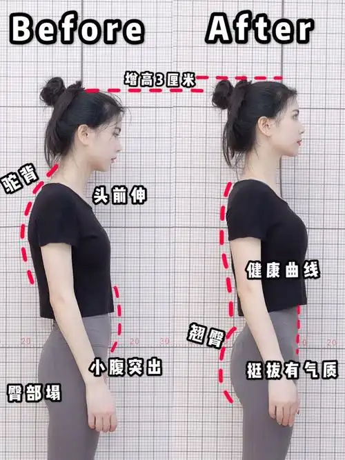 美背驼背矫正背部矫姿学生成年女士超薄隐形矫姿用品