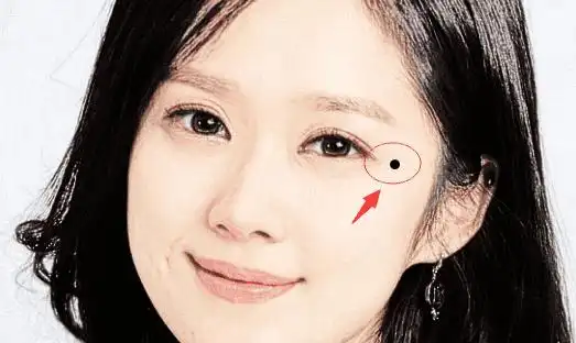 四种带财痣,富贵缠身,不是当官就是富豪!