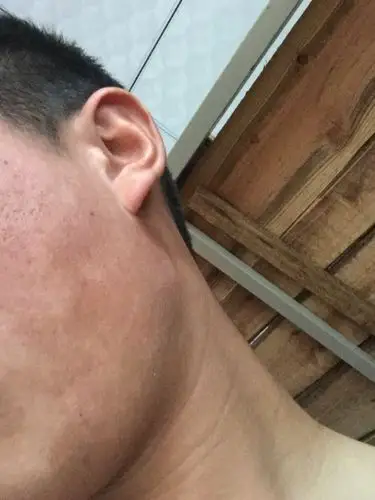 脸上皮肤颜色不均匀 是什么原因