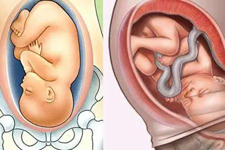 胎动比较频繁,这很正常至于小便频繁,可能与胎儿入盆压迫膀胱有关系