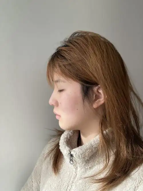 虽然我的鼻梁侧面看也不是很塌,_圈子-新氧美容整形