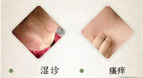 **皮肤瘙痒怎么办