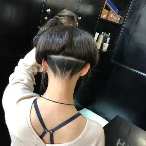 后脑勺想铲青有没有什么建议和注意事项?