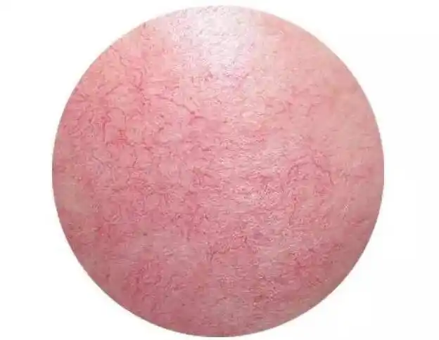 角质层薄和干性肌肤什么关系?这三种关系分析