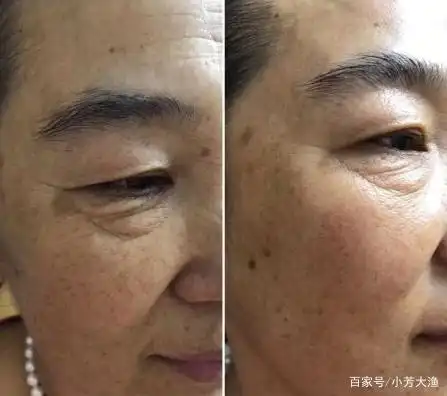 皮肤松弛老化,分析主要原因?