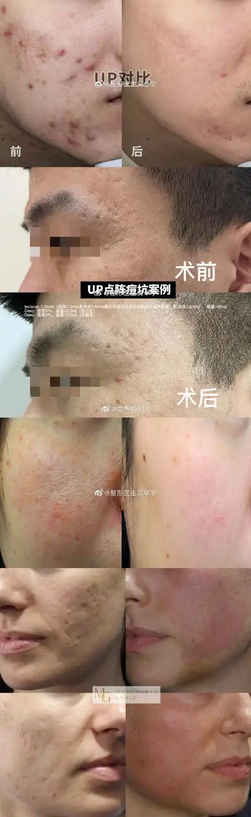 微博颜选##微博变美手册##章鱼包医美功课