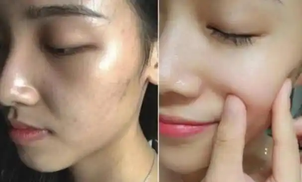 皮肤暗沉无光泽,建议可以尝试这款国货,虽便宜,但能有效补水